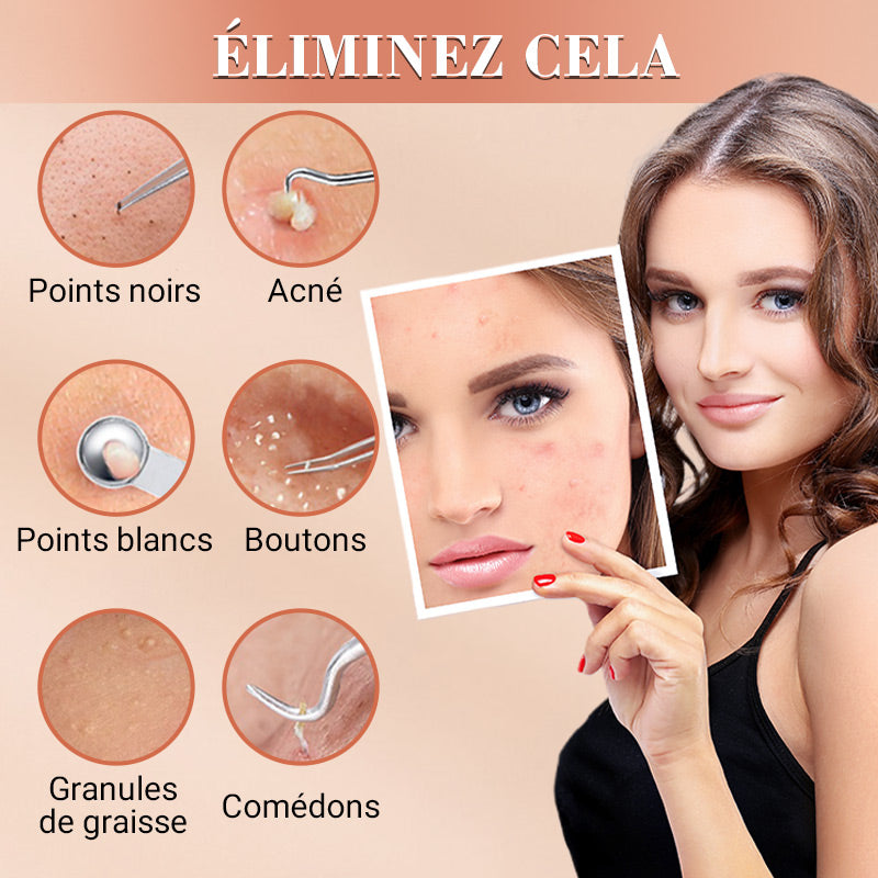💓50 % DE RÉDUCTION💥Kit d'Outils pour l'Extraction de Points Noirs et Boutons