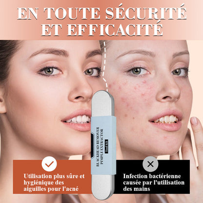 💓50 % DE RÉDUCTION💥Kit d'Outils pour l'Extraction de Points Noirs et Boutons📢📢3 dernières heures : Grande vente⏰⏰