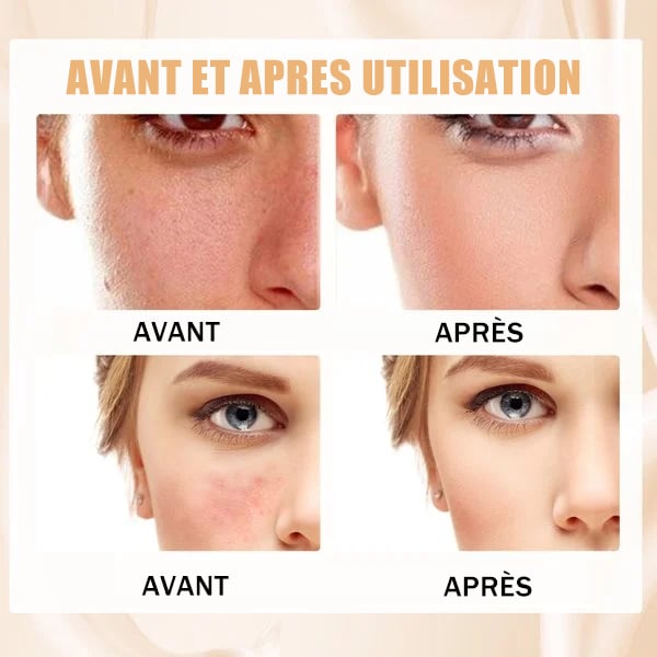 🎁Achetez-en 1, obtenez-en 1 gratuit🎉Fond de teint peau mature à changement de couleur