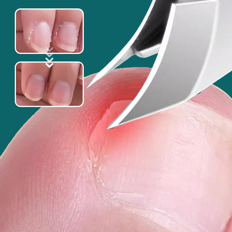 🔥Soins des ongles professionnels💕 Set de 3 pièces de coupe-ongles à bord incliné 25° anti-éclaboussures