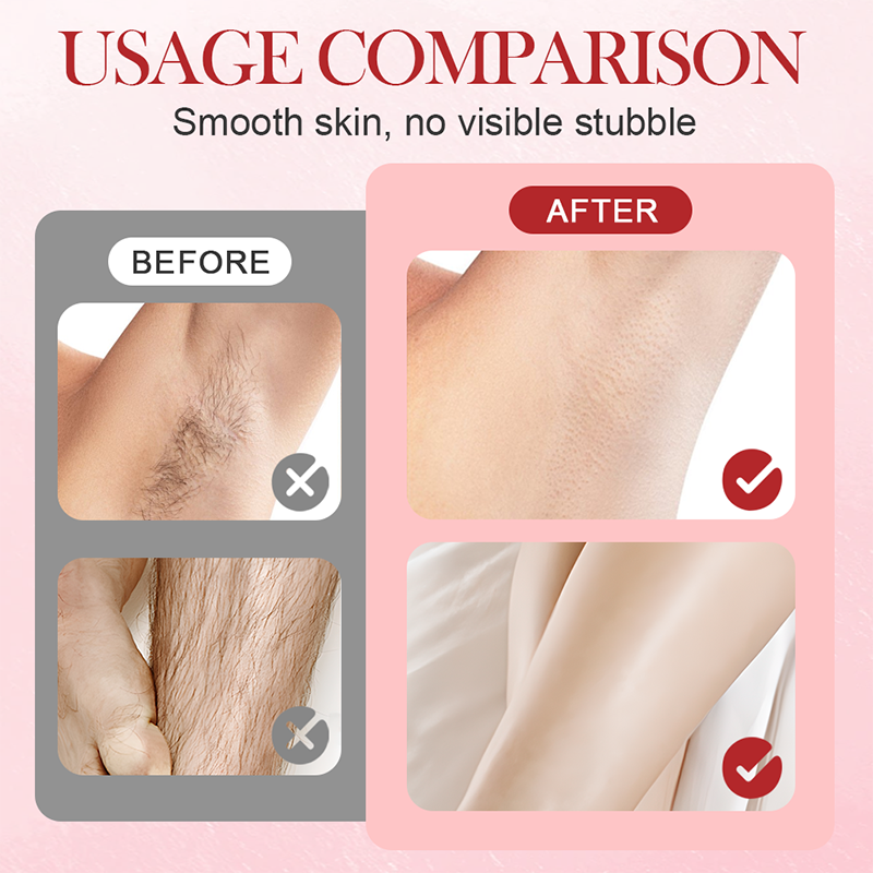 👑Épilateur électrique portable à double tête✨🌿