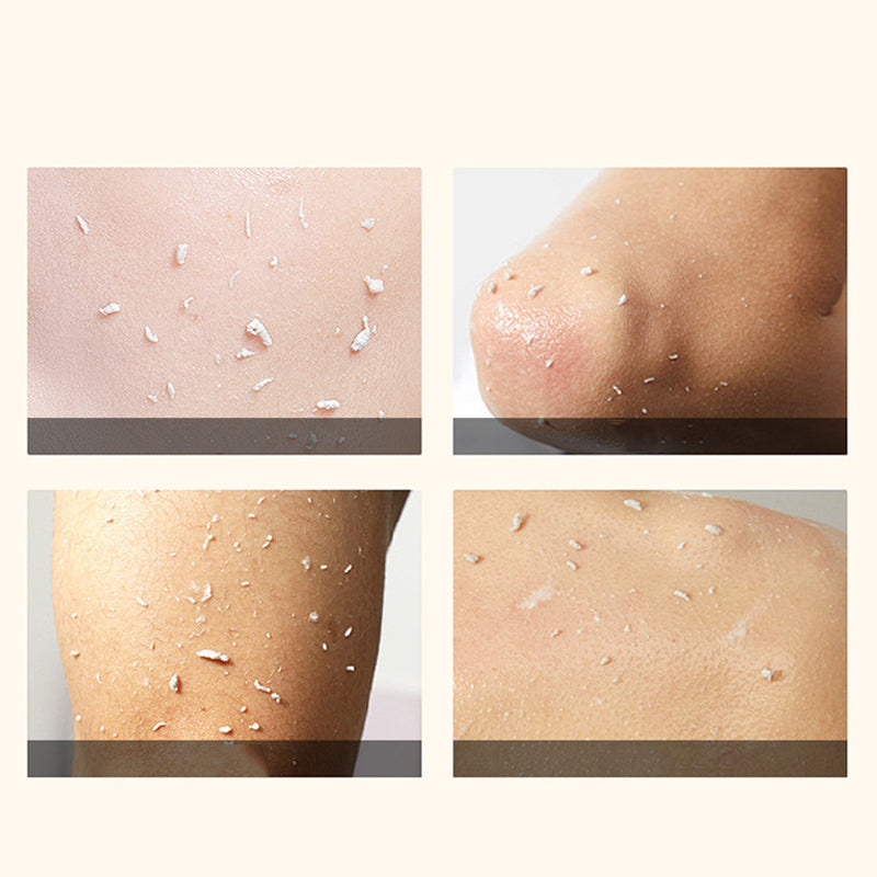 🔥Offres spéciales - Gel exfoliant éclaircissant aux enzymes d'orange